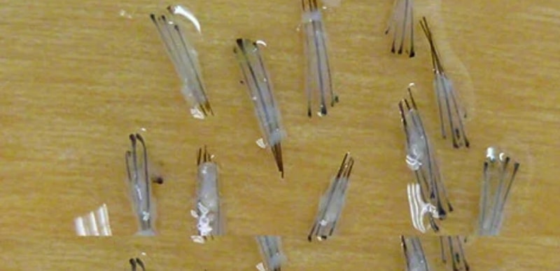 Note the appearance of the grafts that are harvested using follicular unit extraction. The grafts are intact and the supportive fat and surrounding tissue is remarkably preserved even though a 0.8 mm round harvest tool has been used. In situations that require fewer than 3-4 hairs per follicular unit these follicular units can be subdivided for a softer, more delicate result.