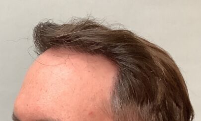 After Image