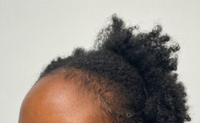 Before Image