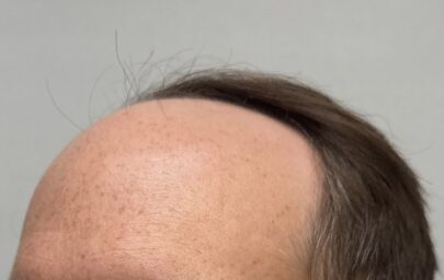 Before Image