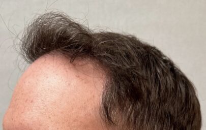 After Image