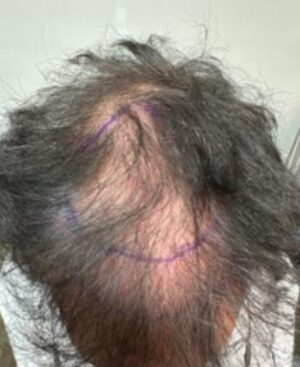 Before Image