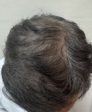 After Image