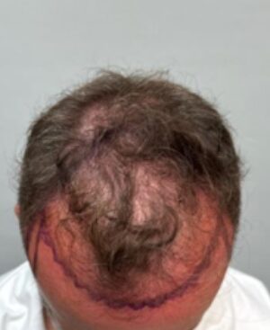 Before Image