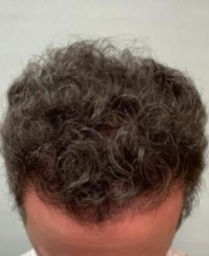 After Image