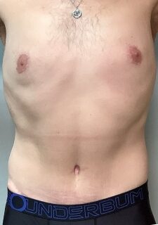 After Image